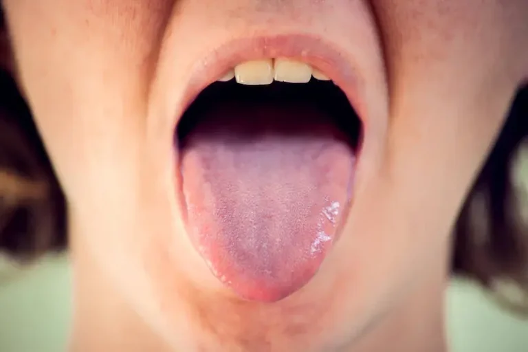 What-Your-Tongue-Color-Reveals-About-Your Health